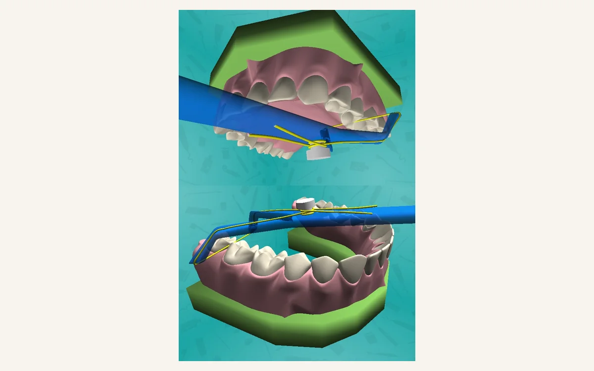 Demonstração de fio dental em um modelo de arcadas dentárias.